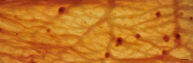 Encysted Worms: Should I Be Worried? - Natural Horse World encysted-cyathostomin-larvae-nielsen-